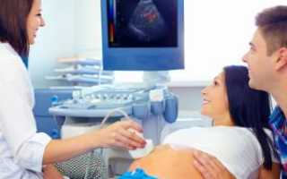 Как расшифровать УЗИ при беременности