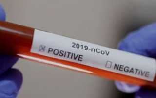 Положительный тест на коронавирус