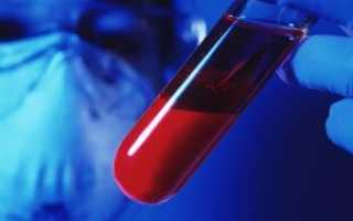 Анализ крови на антитела при беременности