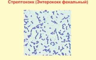 Фекальный энтерококк (Enterococcus Faecalis) в мазке