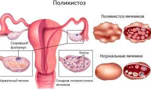 Фазы менструального цикла: схема по дням