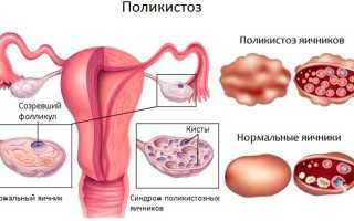 Фазы менструального цикла: схема по дням