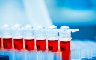 Как сдается анализ крови – натощак или нет?