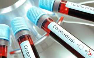 Положительный тест на антитела к коронавирусу