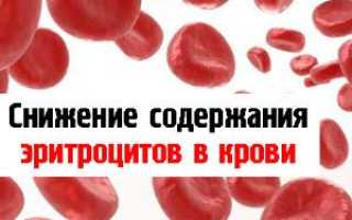 Пониженные эритроциты в крови
