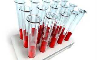 Что такое анализ крови на РФМК