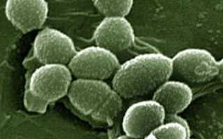Enterococcus faecalis в моче