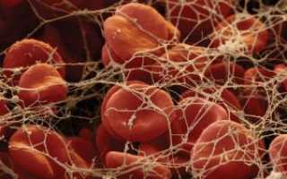 Что такое фибриноген в анализе крови