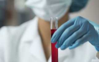 Что такое анализ крови на РМП