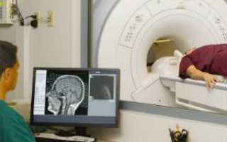 МРТ сосудов головного мозга и шеи