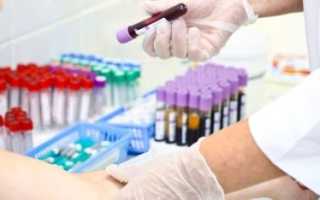 Анализы крови на онкомаркеры