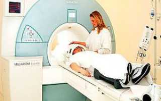 Показания для МРТ головного мозга