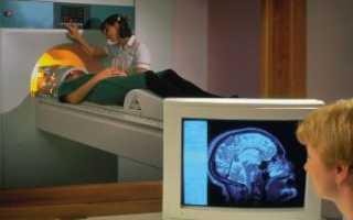 Обзорное МРТ головного мозга