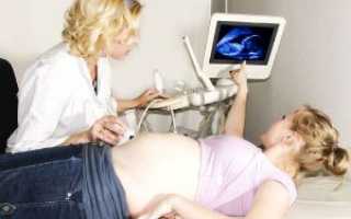 УЗИ на 15 неделе беременности