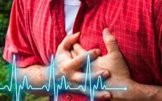 Блокады сердца на электрокардиограмме