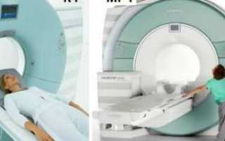Отличие КТ от МРТ головного мозга