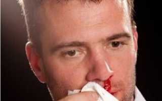 Кровь из носа при коронавирусе