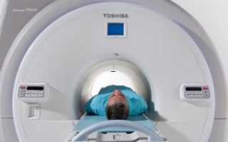 Магнитно-резонансная томография (МРТ) суставов
