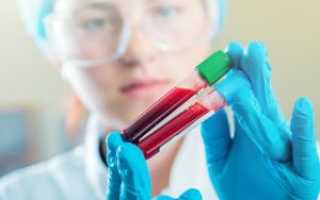 Гипохромия в общем анализе крови