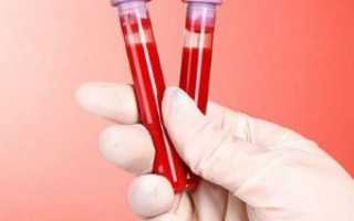 Расшифровка анализа крови на ХГЧ