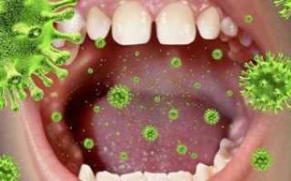 Сухость во рту как симптом коронавируса