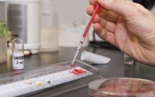 Анализ крови на стерильность