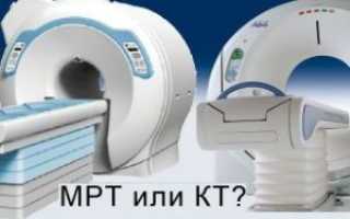 Отличия между КТ и МРТ