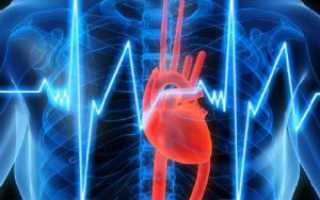 Как расшифровать кардиограмму сердца