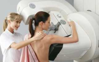 Что такое маммография