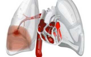 Симптомы и диагностика сердечного кашля