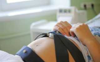 Норма показателей КТГ при беременности