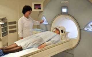 Противопоказания к МРТ головного мозга