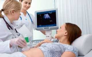 УЗИ мочевого пузыря у беременной женщины